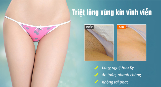 lại bỏ lông vùng kín an toàn